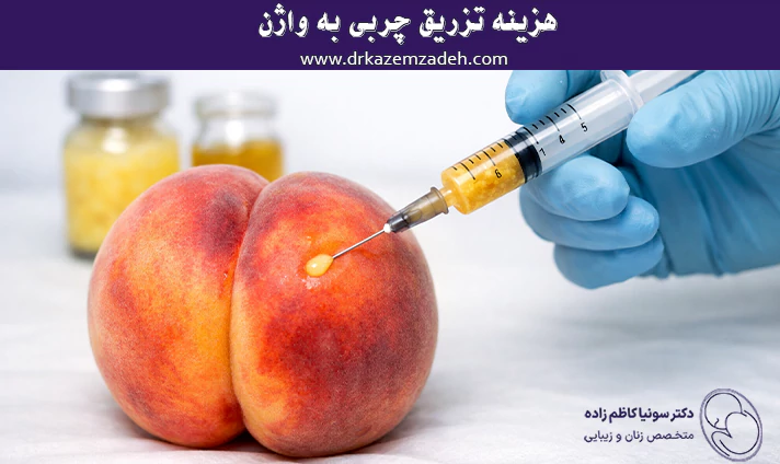 هزینه تزریق چربی به واژن
