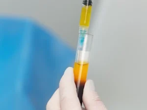 جوانسازی واژن با پی آر پی