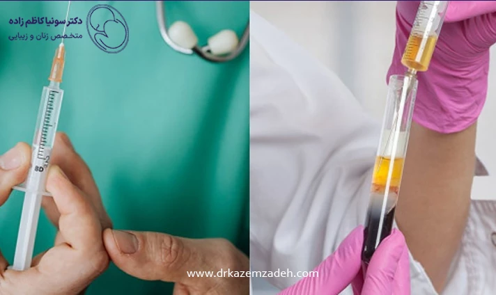 مزایای پی ار پی واژن