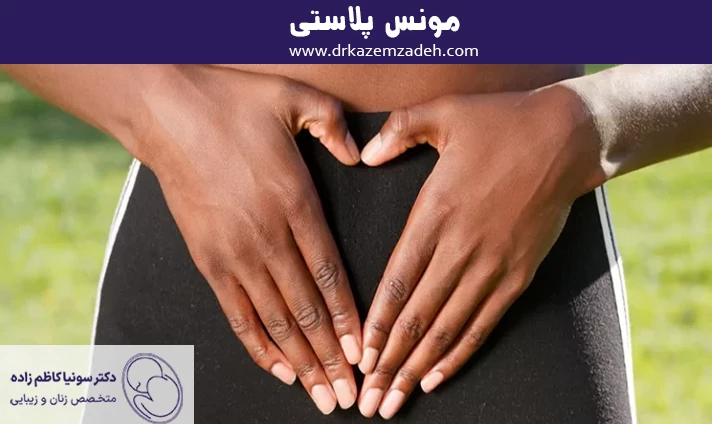 مونس پلاستی