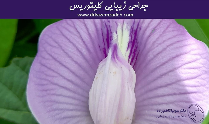 جراحی زیبایی کلیتوریس