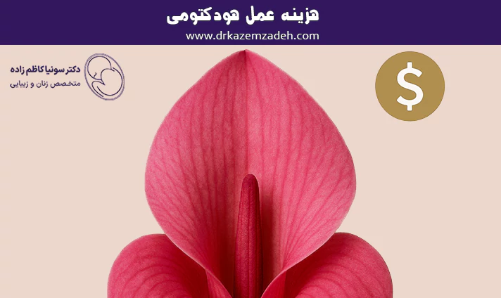 هزینه عمل هودکتومی