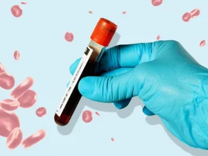 تفسیر آزمایش HSV