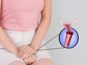 درمان بوی بد واژن