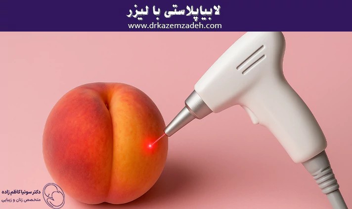 لابیاپلاستی با لیزر