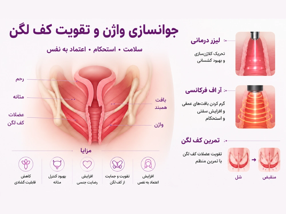تنگ کردن واژن