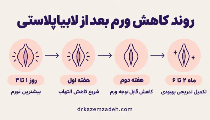 روند کاهش ورم بعد از لابیاپلاستی از روز اول تا شش ماه و مراحل بهبودی تورم لابیاها